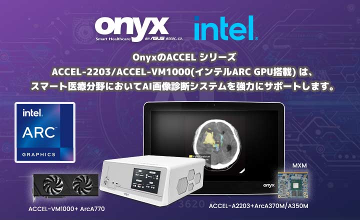 OnyxのACCEL シリーズACCEL-2203/ACCEL-VM1000(インテルARC GPU搭載) は、スマート医療分野においてAI画像診断システムを強力にサポートします。